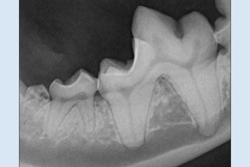 Full mouth dental radiographs look for disease under the gum line where we can't visualize and our patients can't tell us it hurts.